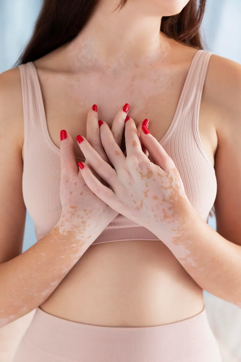 Mutações BRCA1 e BRCA2 — aconselhamento genético